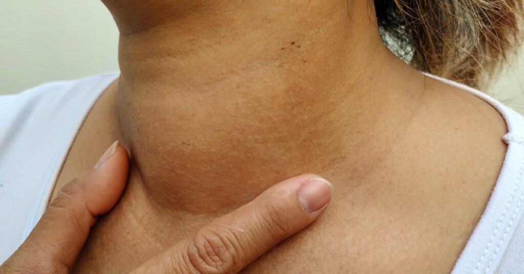 మెడ నలుపు నుండి విముక్తి పొందడానికి సులభమైన చిట్కాలు