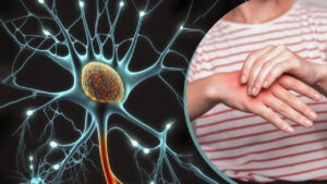 రాష్ట్రంలో తొలి గులియన్ బారే సిండ్రోమ్ కేసు నమోదు