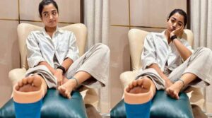 గాయంతో హీరోయిన్ రష్మిక..ఫొటోస్ వైరల్