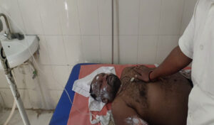 యాదాద్రిలో పేలుడు: ఒకరు మృతి, ఎనిమిది మందికి గాయాలు