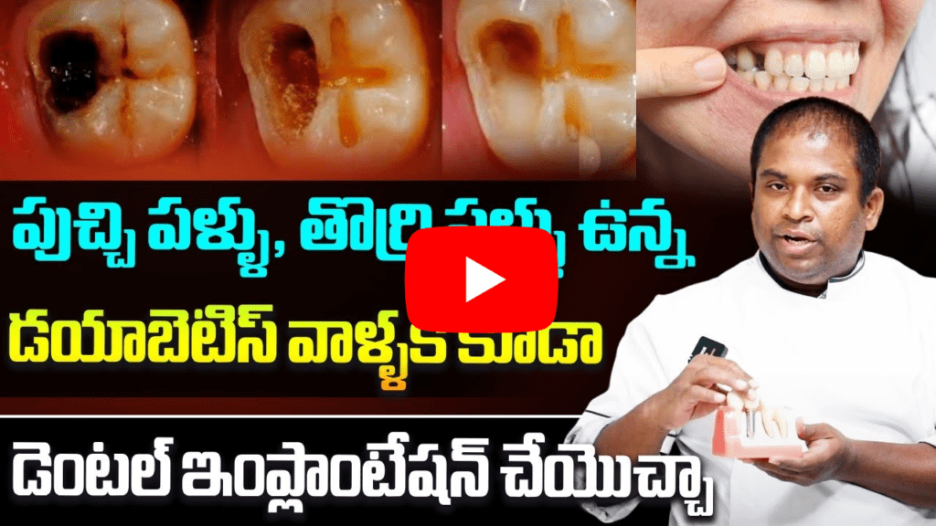 డయాబెటిస్