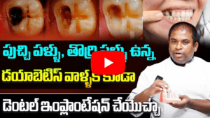 డయాబెటిస్ వాళ్ళకి కూడా Dental Implant చేయొచ్చా