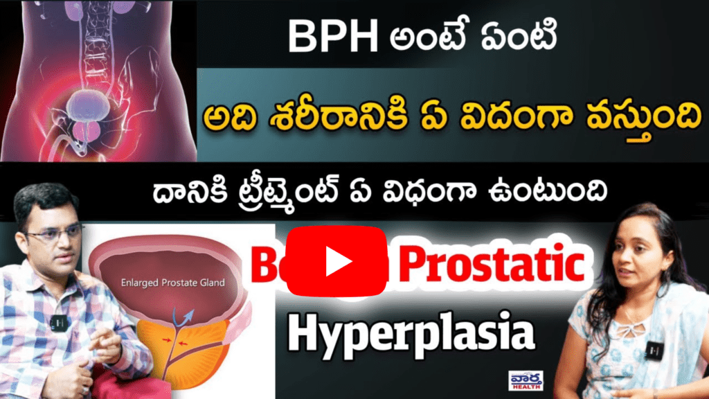 BPH అంటే ఏంటి