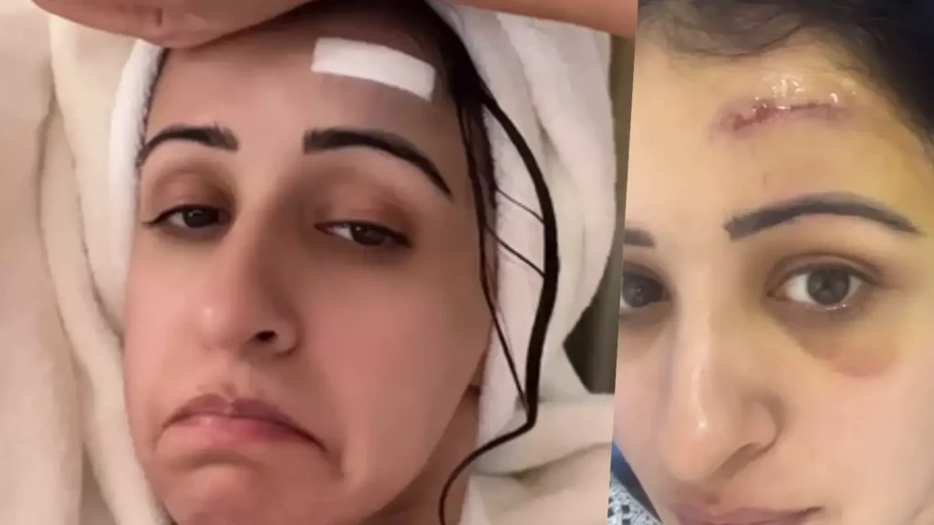 Anshu: ఇది పబ్లిక్ స్టంట్ కాదు నిజమైన గాయం: అన్షు