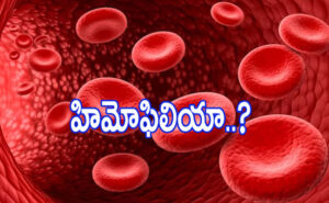 రాయల్ డిసీజ్ పై పూర్తి అవగాహన