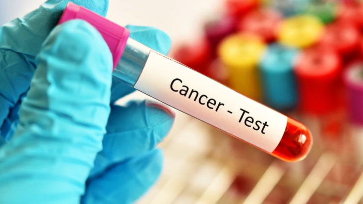 Free cancer screening: తెలంగాణలో ఉచిత క్యాన్సర్ పరీక్షలకు ఏర్పాటు