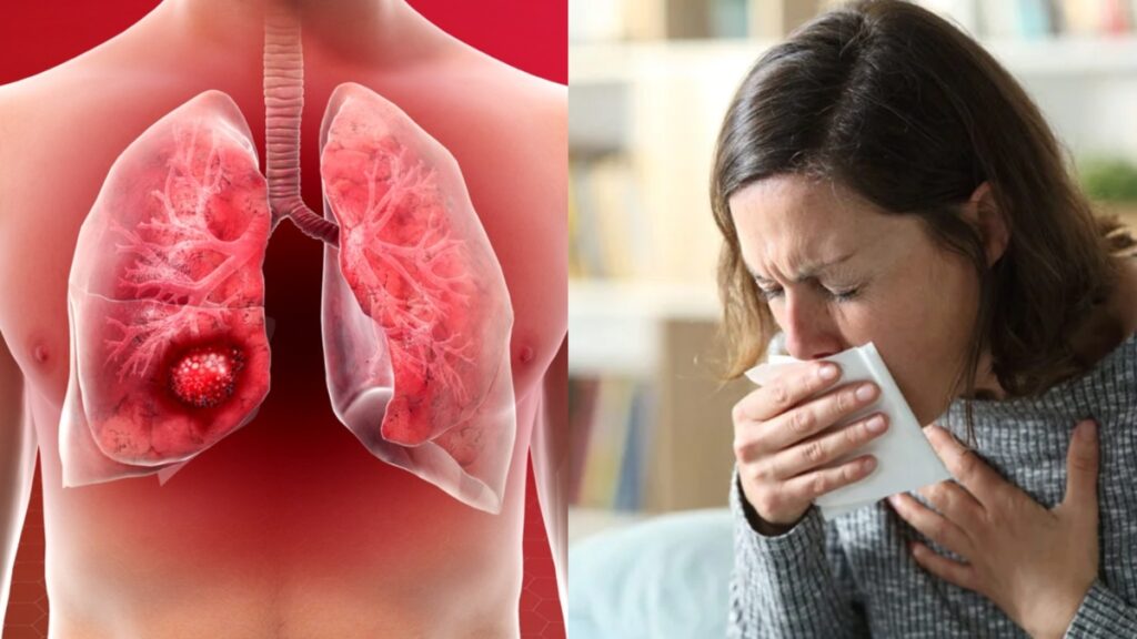 Lung cancer: లంగ్ క్యాన్సర్ లక్షణాలు-నివారణ చర్యలు