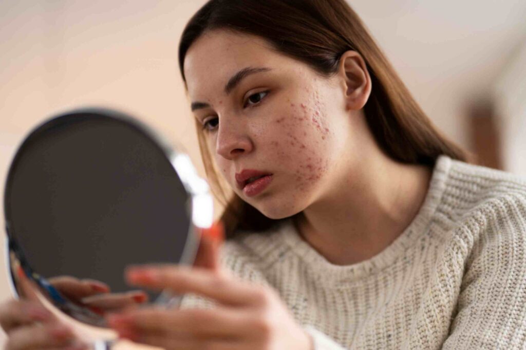 jpeg optimizer person dealing with rosacea 1 1 scaled