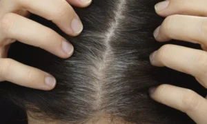 ఈ టిప్స్ పాటిస్తే తెల్ల జుట్టు పెరగదు