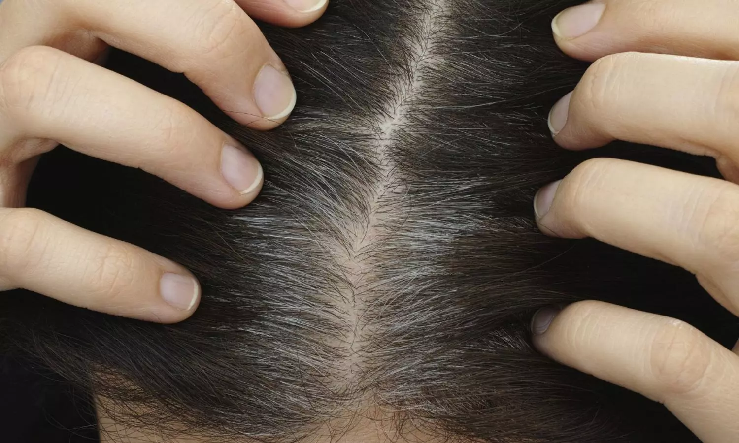 White hair: ఈ టిప్స్ పాటిస్తే తెల్ల జుట్టు పెరగదు
