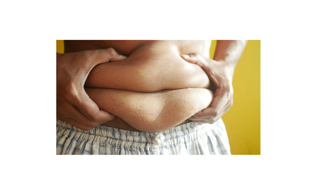 Obesity : స్థూల‌కాయం స‌మ‌స్య‌ను అధిగమించడం ఎలా?