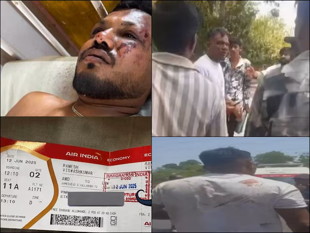 Ahmedabad Plane Crash : విమాన ప్రమాదం నుంచి ఒకే ఒక్కడు ప్రాణాలతో బయటపడ్డాడు కానీ…