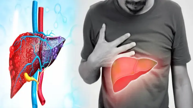 Fatty liver: ఫ్యాటీ లివర్ తో గుండెకు పొంచి ఉన్న ముప్పు