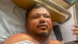 ప్రమాదంలో ప్రాణాలతో బయటపడిన బ్రిటన్ జాతీయుడు