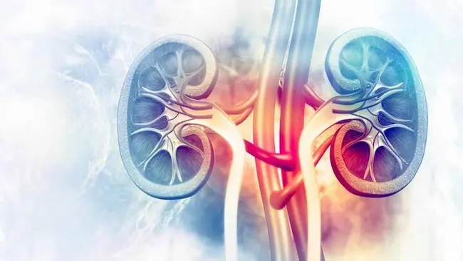 World Kidney Cancer Day: నేడు కిడ్నీ క్యాన్సర్ డే