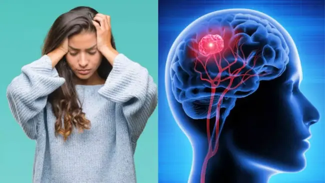 Brain tumor: బ్రెయిన్ ట్యూమర్ లక్షణాలు..నివారణ చర్యలు