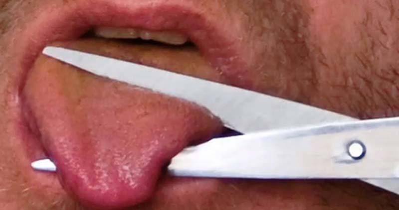 Medak : డబ్బులివ్వలేదని తండ్రి నాలుక కోసేసిన కొడుకు