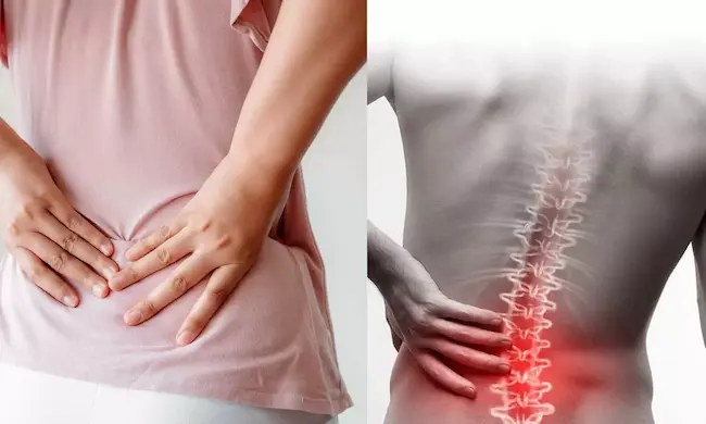 Back Pain: అవసరానికి మించి శ్రమించడమే నడుము నొప్పికి కారణాలు