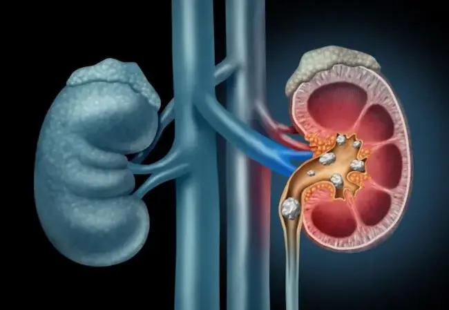 Kidneys: కిడ్నీ సమస్యల ముందు తెలిపే శరీర సంకేతాలు ఇవే!