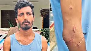 Nandyal : నంద్యాల జిల్లాలో  పొలానికి వెళ్లిన యువకుడిపై పెద్దపులి దాడి