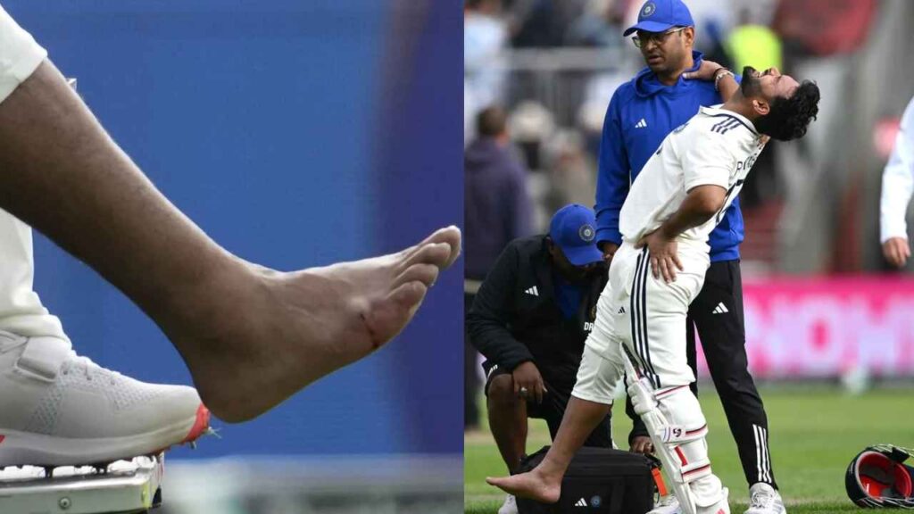 Rishabh Pant: పంత్‌కు కుడికాలికి తీవ్ర గాయం