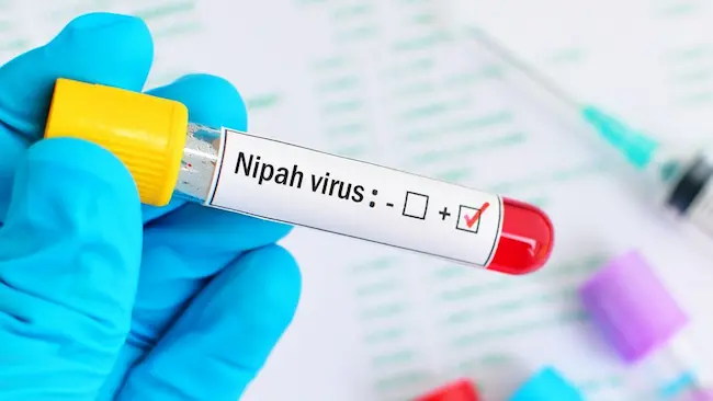 Nipah Virus : ఆందోళన కలిగిస్తున్న నిఫా వైరస్‌..  కేరళలోని ఆరు జిల్లాల్లో హై అలర్ట్‌