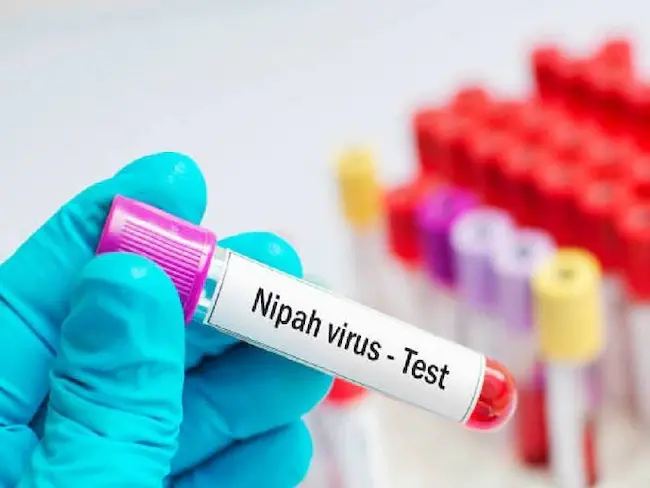 Nipah Virus : ఆందోళన కలిగిస్తున్న నిఫా వైరస్‌.. కేరళలోని ఆరు జిల్లాల్లో హై అలర్ట్‌