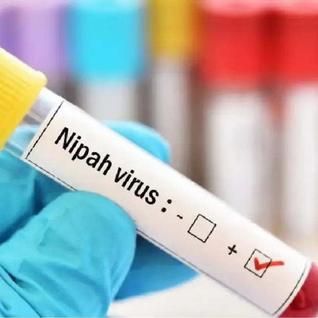 Nipah Virus: కేరళలో నిఫా కలకలం ..18ఏళ్ల యువతి మృతి