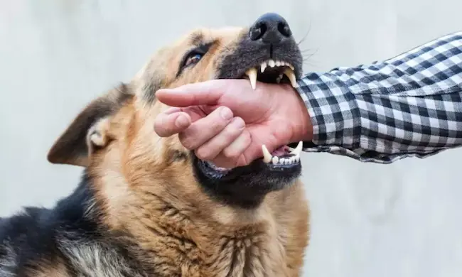 News Telugu: Dog Bite- కుక్క కరిచిన వెంటనే ఎలాంటి జాగ్రత్తలు తీసుకోవాలి?
