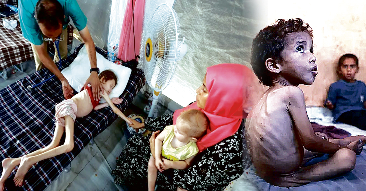 Gaza : గాజాలో తీవ్ర కరవు నెలకొంది : ప్రకటించిన ఐక్యరాజ్యసమితి