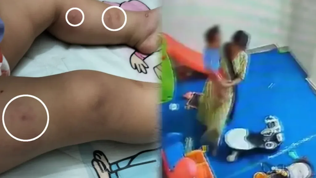 Noida day care: చిన్నారి పట్ల అమానుషంగా ప్రవర్తించిన డే కేర్‌ ఆయా