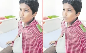 Visakhapatnam- ఇదేం క్రమశిక్షణ టీచర్..మాట వినలేదని స్టూడెంట్ చేయి విరగొడతారా!