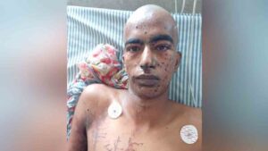 బాంబు తయారు చేస్తుండగా పేలడంతో బయటపడిన కుట్ర