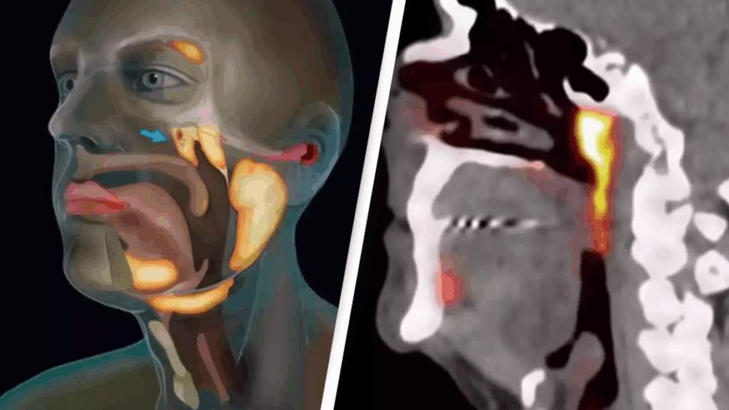 Vaartha live news : human body : 300 ఏళ్ల తర్వాత మానవ శరీరంలో కొత్త అవయవం ఆవిష్కరణ