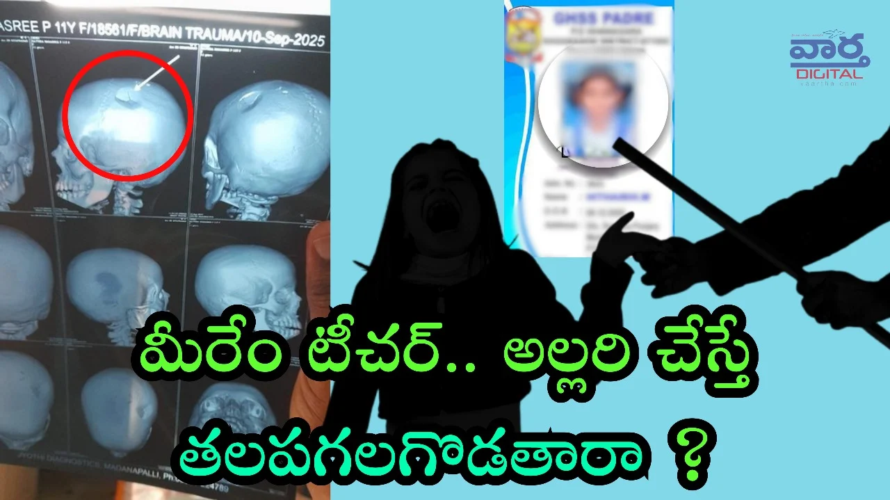 Bhashyam School-చిన్నారి తల పగలగొట్టిన టీచర్