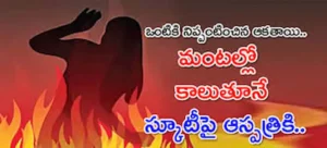 Uttar Pradesh – మహిళకు నిప్పంటించిన దుండగుడు.. మంటల్లోనే స్వయంగా ఆసుపత్రికి వచ్చిన వైనం