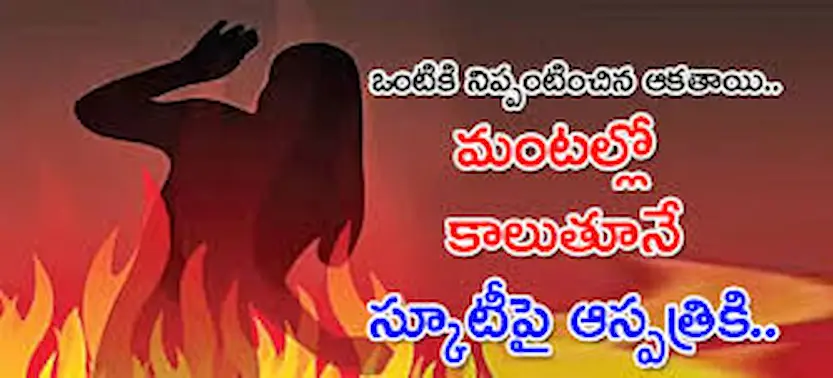 News Telugu: Uttar Pradesh – మహిళకు నిప్పంటించిన దుండగుడు.. మంటల్లోనే స్వయంగా ఆసుపత్రికి వచ్చిన వైనం