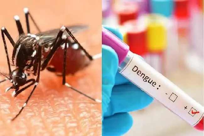 Dengue – Typhoid -  డెంగ్యూ – టైఫాయిడ్ మధ్య తేడా ఇదే.. ఈ లక్షణాలు యమ డేంజర్