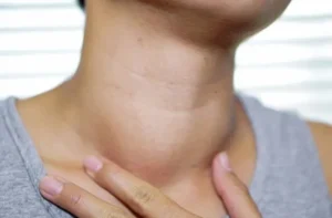 Thyroid – థైరాయిడ్ సమస్యతో బాధపడుతున్నారా? ఐతే ఈ జాగ్రత్తలు తీసుకోండి..