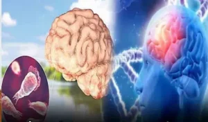 వేగంగా వ్యాపిస్తున్న అమీబా కేసులు.. 19 మంది మృతి