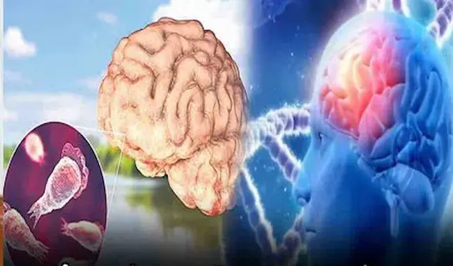 News telugu: Kerala: వేగంగా వ్యాపిస్తున్న అమీబా కేసులు.. 19 మంది మృతి