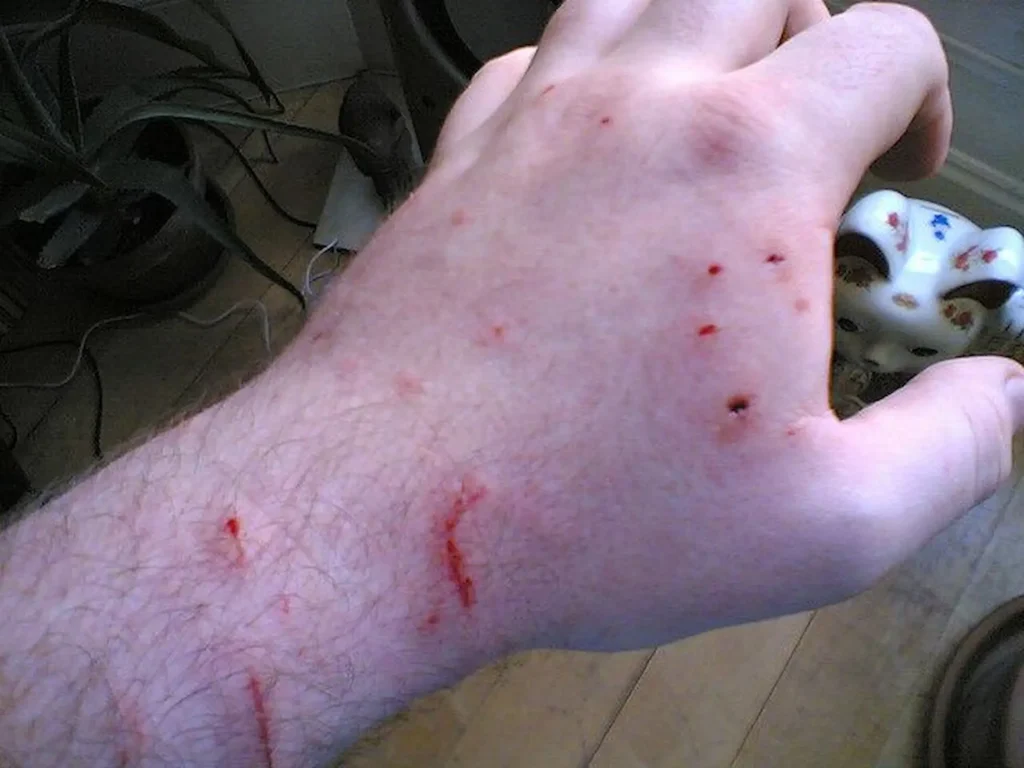 Cat bite