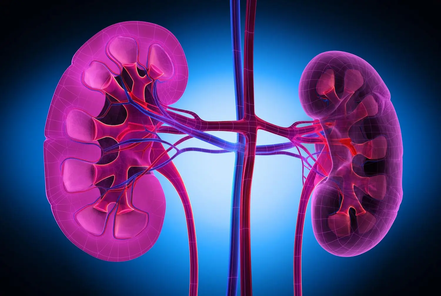kidney disease