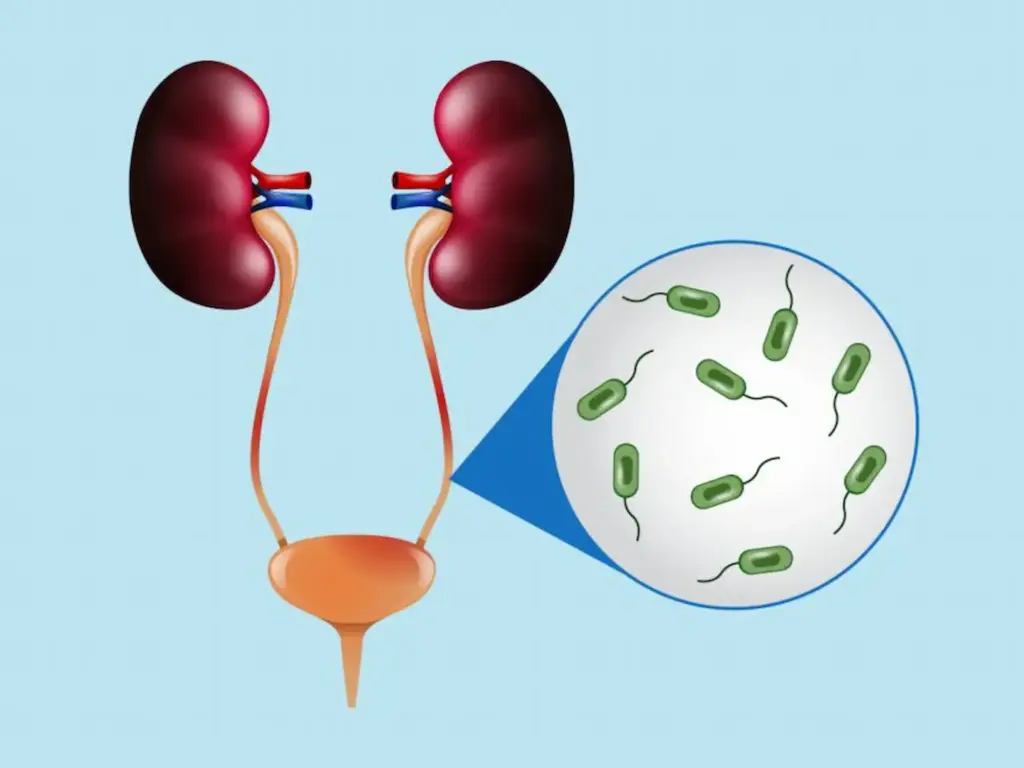 UTI Infections: అపరిశుభ్ర వంటగది..