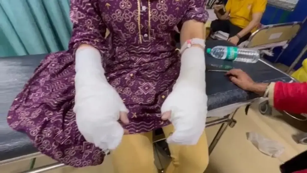 Latest News: Delhi Crime: కాలేజీ విద్యార్థినిపై యాసిడ్ దాడి చేసిన ప్రేమోన్మాది