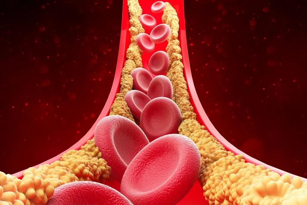 Cholesterol: ఈ టిప్స్ పాటిస్తే కొలెస్ట్రాల్ ఇట్టే మాయం
