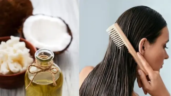 Coconut Oil :  జుట్టు స‌మ‌స్య‌లకు కొబ్బ‌రినూనెను ఎలా ఉపయోగించాలో తెలుసా..