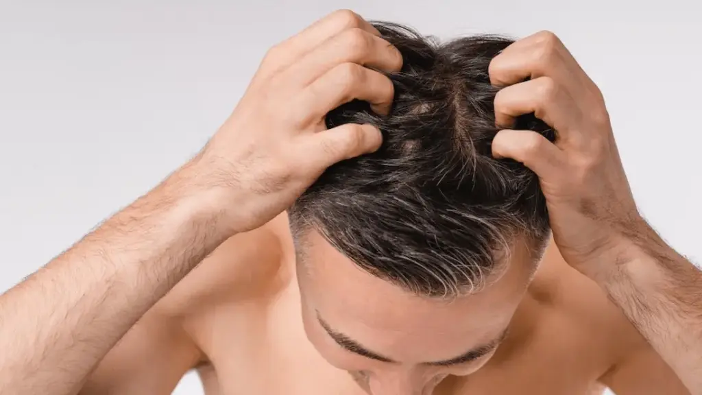 Hair Growth: బట్టతల వారికి శుభవార్త!