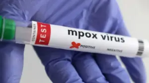 భయపెడుతున్న మరో మహమ్మరి .. తొలి కేసు నమోదు!