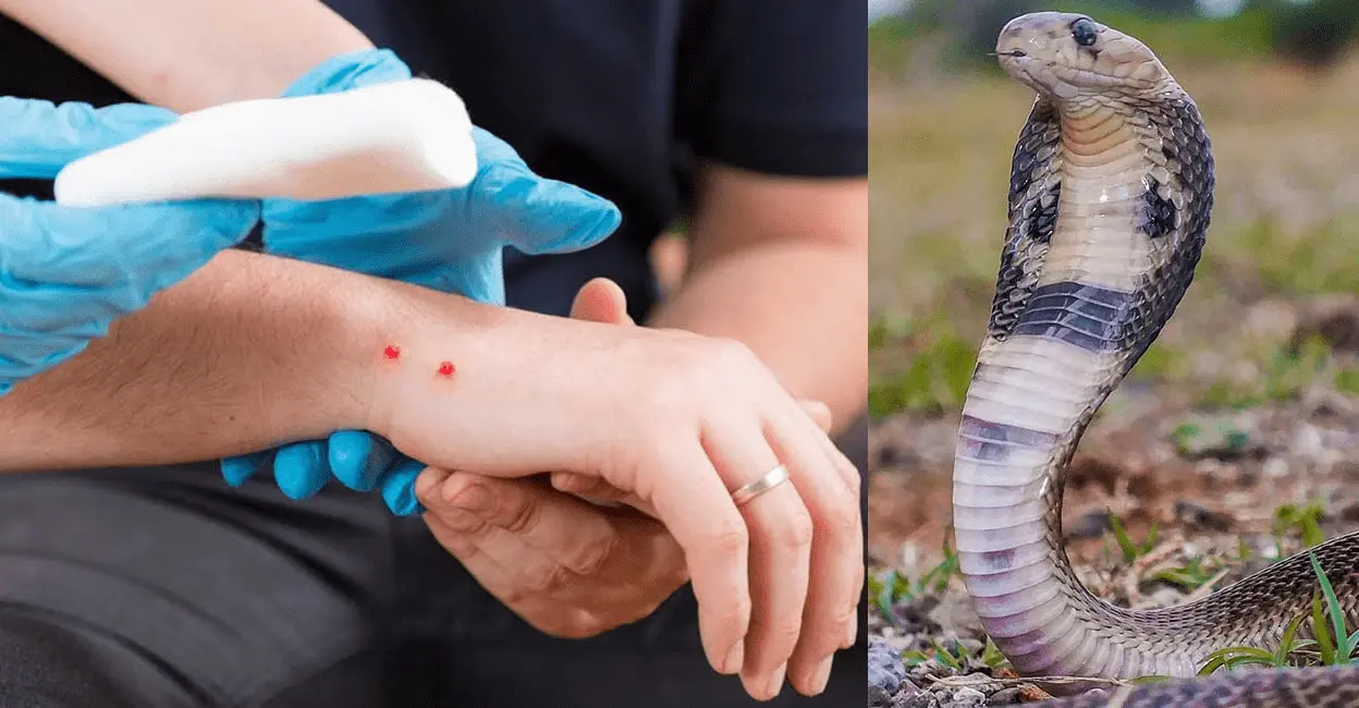 MadhyaPradesh: చనిపోతూ కసి తీర్చుకున్న పాము.. మృత్యువు చేరుకున్న యువతీ